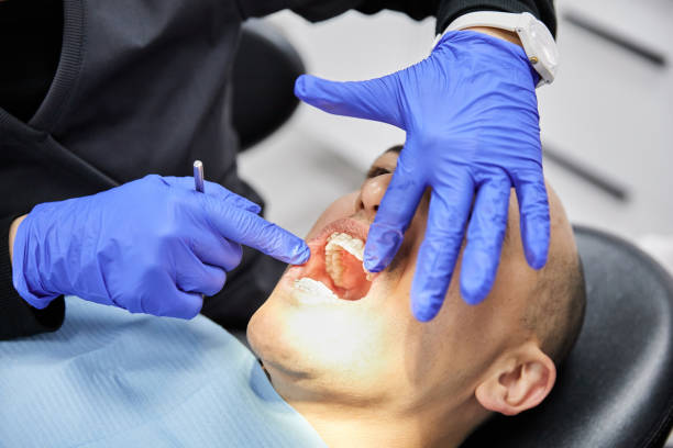 Best Emergency Root Canal Treatment in Howell, MI